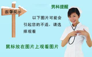 梅毒初期癥狀圖片