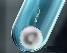 死精癥的治療方法