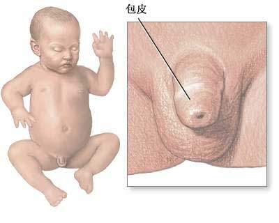小孩幾歲做包莖手術比較好
