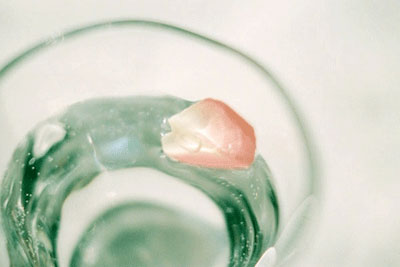 鞘膜積液是怎么形成的?